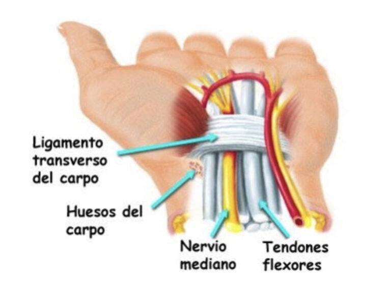 blog-sindrome-tunel-carpiano-doctor-galan